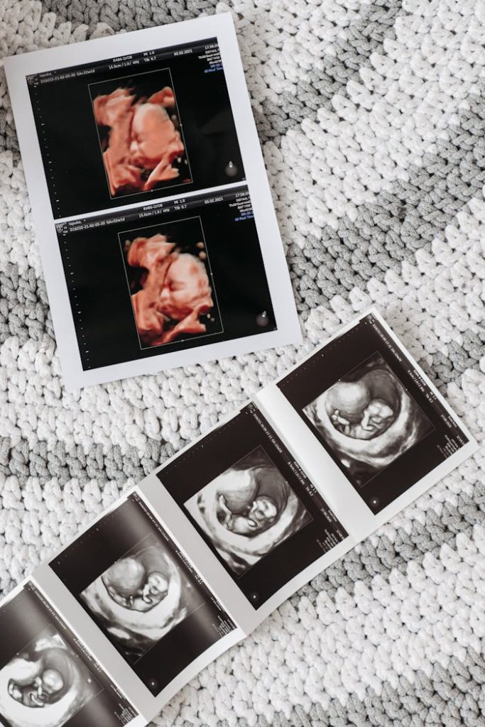 Close-up ultrasound images showing prenatal development on textured background.
